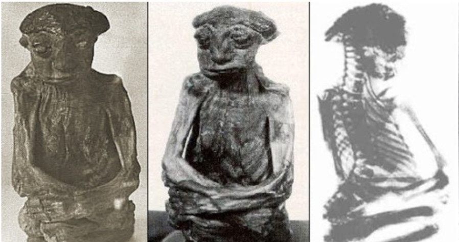 Prześwietlenie szkieletu mumii z San Pedro /domena publiczna