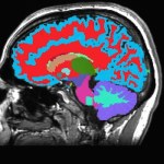 Przewidzieć demencję? Ta metoda daje nadzieję