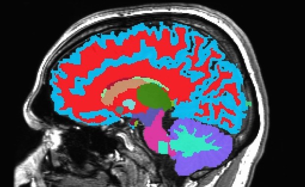Przewidzieć demencję? Ta metoda daje nadzieję
