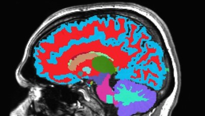 Przewidzieć demencję? Ta metoda daje nadzieję