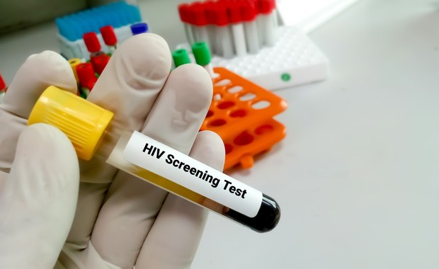Przez pandemię Covid-19 spadła wykrywalność zakażeń HIV