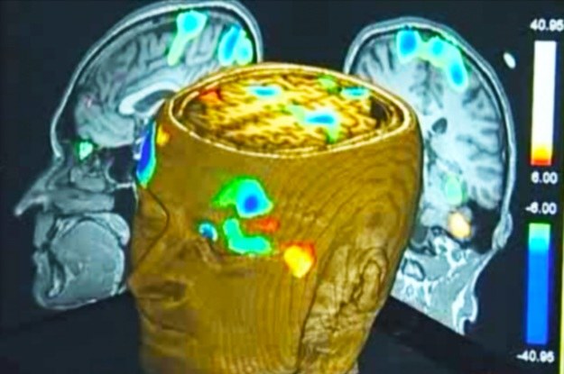 Przy pomocy fMRI można monitorować aktywność mózgu także pacjentów w stanie wegetatywnym /materiały prasowe