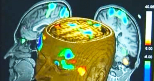 Przy pomocy fMRI można monitorować aktywność mózgu także pacjentów w stanie wegetatywnym /materiały prasowe
