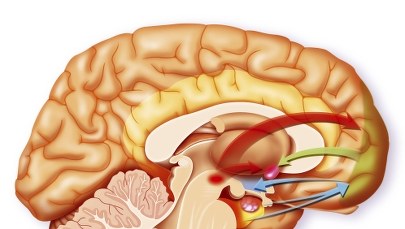 Przy udarze mózgu kluczowa jest szybka pomoc