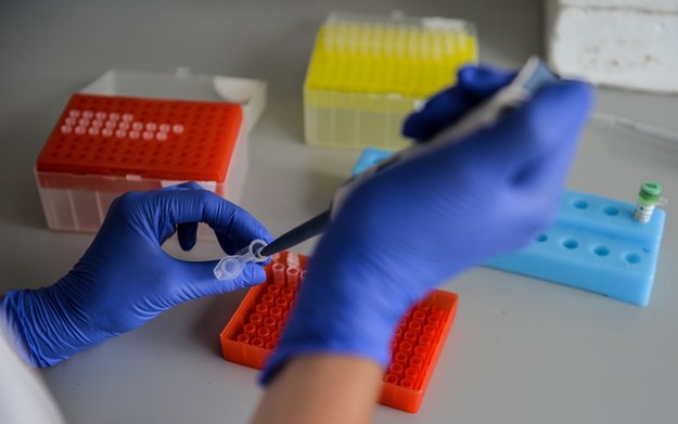 Przykładowe badanie techniką PCR, która ma zastosowanie m.in. w wykrywaniu infekcji bakteryjnych i wirusowych /Marcin Obara /PAP