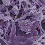 Przypadek krymsko-kongijskiej gorączki krwotocznej zidentyfikowany w Wielkiej Brytanii 