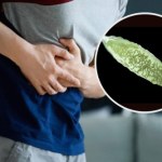 Przywra latem atakuje częściej. Upośledza wątrobę i rujnuje zdrowie