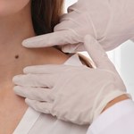 Pyrzyce: W niedzielę dermatolodzy za darmo ocenią znamiona skórne