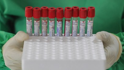 Radom: Na COVID-19 zmarło dwóch księży seniorów