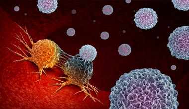 Rak jelita grubego dotyka tysięcy Polaków. Naukowcy z przełomowym odkryciem