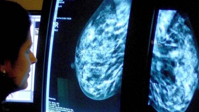 "Rak piersi to nie wyrok”