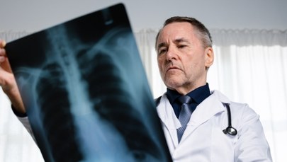 Rak płuca pod lupą. Szykują się ważne zmiany dla Polaków