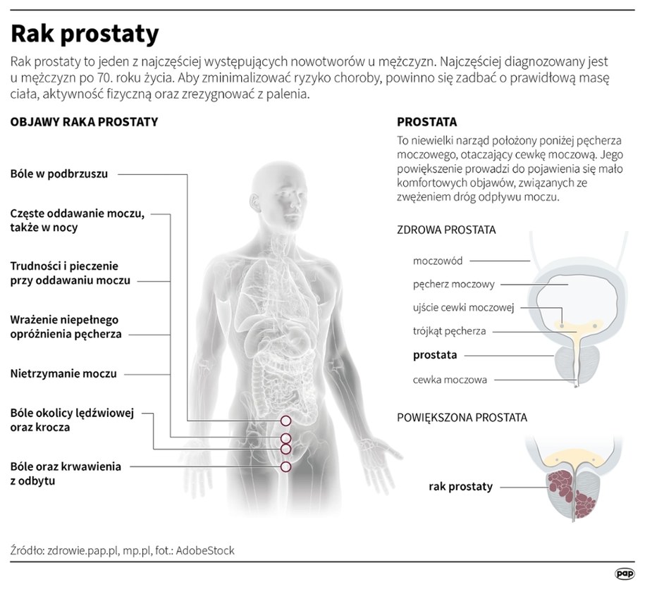 rak prostaty /Maria Samczuk, Mateusz Krymski /PAP