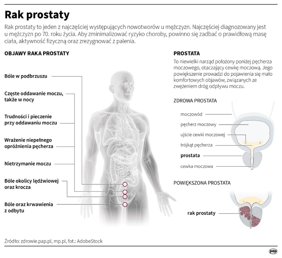 Rak prostaty /Maria Samczuk, Mateusz Krymski /PAP