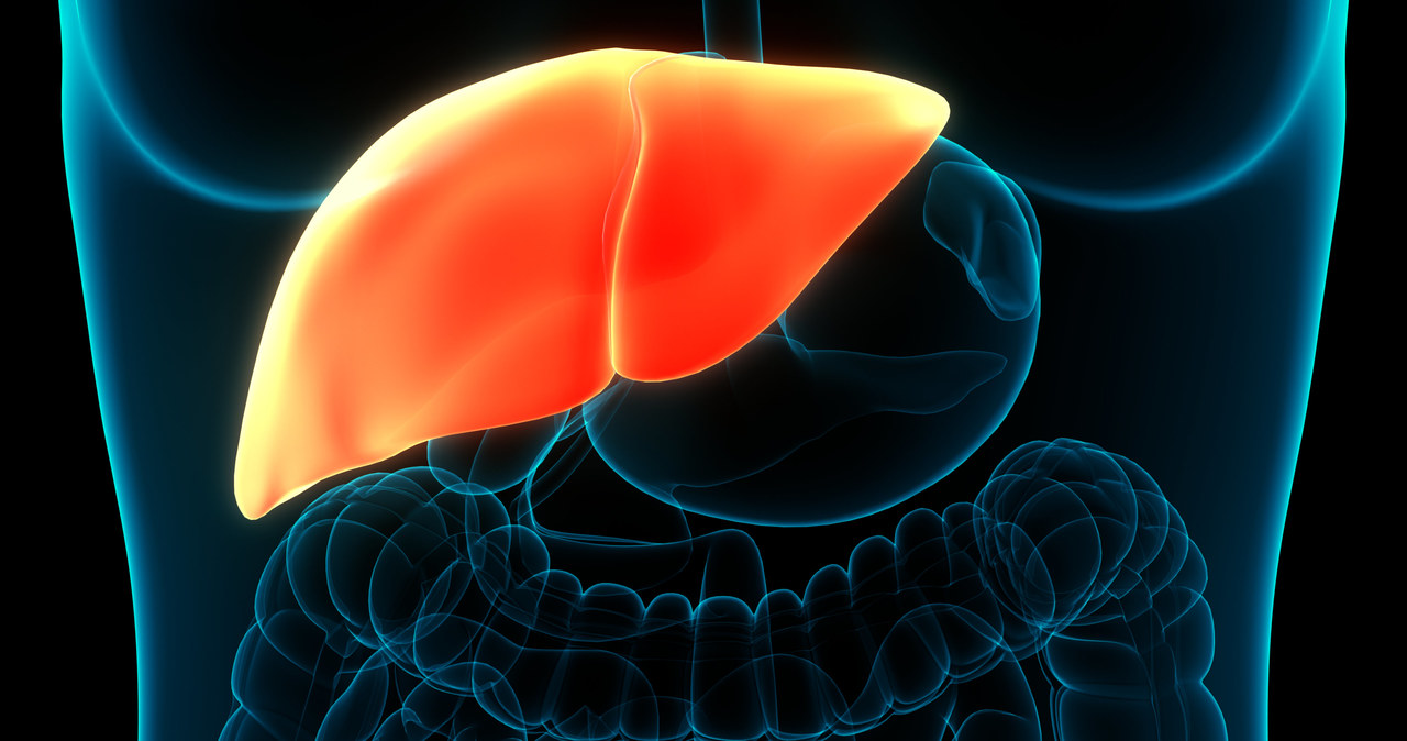 Rak wątroby w Polsce wykrywany jest co roku w liczbie ok. 1400 przypadków /123RF/PICSEL