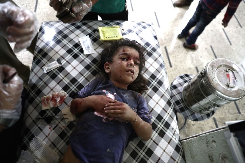 Ranna dziewczynka w syryjskim szpitalu /AFP