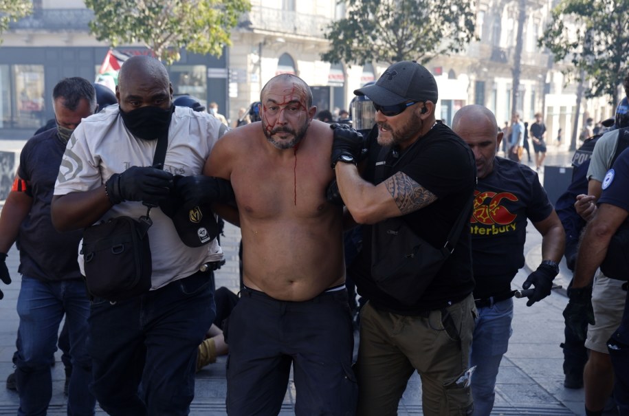 Ranni w starciach we francuskim Montpellier /GUILLAUME HORCAJUELO  /PAP/EPA