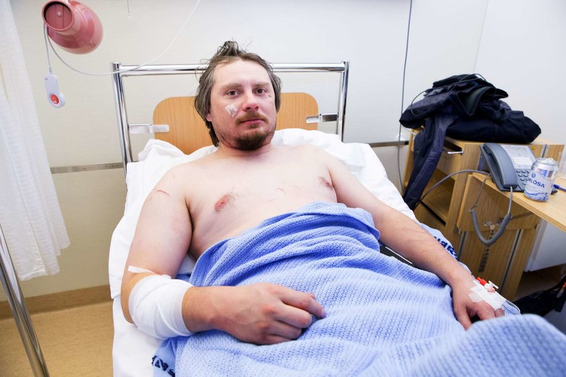 Ranny Jakub Moravec, którego w namiocie na Spitsbergenie zaatakował niedźwiedź polarny /AFP