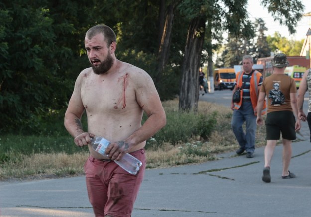 Ranny mężczyzna po rosyjskim ataku na Wilnianśk. /Kateryna Klochko /PAP/EPA