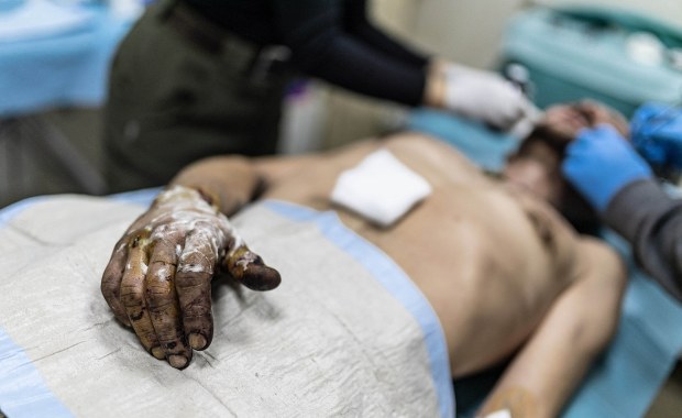 Ranny Ukrainiec czekał 33 dni. Wysłali po niego robota