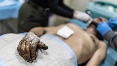 Ranny Ukrainiec czekał 33 dni. Wysłali po niego robota