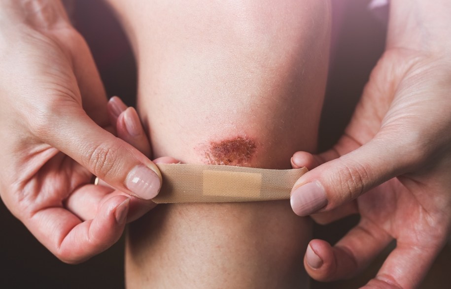 Rany u ludzi goją się trzy razy wolniej niż u innych ssaków /Shutterstock