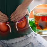 kamica nerkowa leczenie Ratunek dla nerek i pęcherza. Wymiata bakterie i piasek z przewodów moczowych