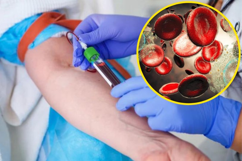 RDW-CV to badanie wchodzące w skład morfologii, które określa zmienność objętości czerwonych krwinek /123RF/PICSEL