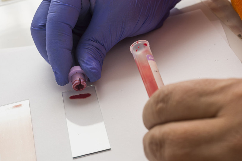 Regularne badanie krwi pomoże zdiagnozować lub wykluczyć anemię /123RF/PICSEL