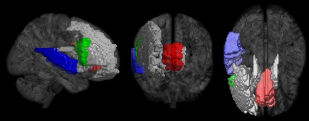 Rejony mózgu istotne w odbiorze muzyki: przedni zakręt obręczy (czerwony), prawy zakret czołowy dolny (zielony), prawy zakręt skroniowy górny (niebieski), jądro ogoniaste (szare), zakręt czołowy środkowy i zakręt czołowy dolny. /University of Jyväskylä /Materiały prasowe