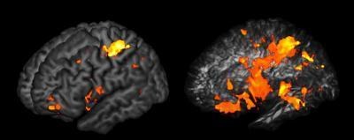 Rejony mózgu (po lewej) i ich połączenia (po prawej) ważne dla naszej inteligencji &nbsp; /PNAS