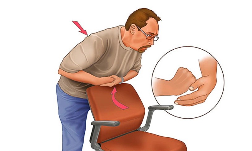 Rękoczyn Heimlicha polega na wywarciu nacisku na przeponę w celu zwiększenia ciśnienia w klatce piersiowej. Można go wykonać samemu w domu przy pomocy oparcia krzesła /Twitter