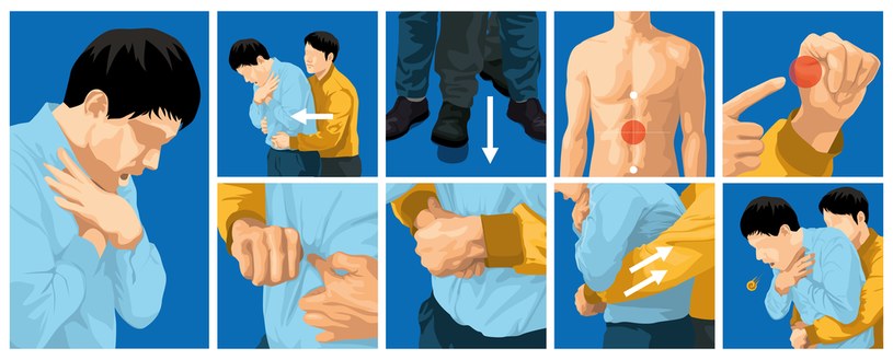 Rękoczyn Heimlicha to metoda, którą powinien znać każdy, ponieważ pozwala uratować życie podczas zadławienia, a więc w sytuacji, gdy należy działać natychmiast. Trzeba pamiętać, że niedotleniony mózg umiera w zaledwie kilka minut. /123RF/PICSEL