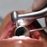 Rekordowa liczba chętnych na stomatologię