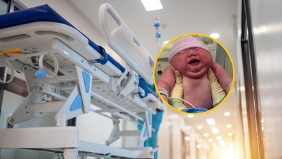 ​Rekordowy poród. Noworodek ważył niemal 6 kilogramów