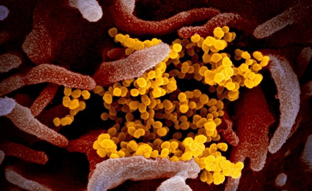 Remdesvir, lek przeciwko koronawirusowi poddany testom