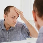 Rewolucyjna terapia na wypadanie włosów. Skuteczność niemal stuprocentowa