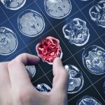 Rewolucyjny test na Alzheimera! Prosto z palca i bez wychodzenia z domu?