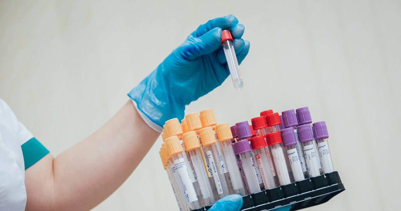 Rób raz w roku, jeśli masz wysoki cukier. Tak ochronisz nerki, oczy i serce /123RF/PICSEL