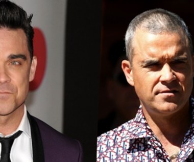 Robbie Williams pogodził się z utratą włosów. "Pora to zaakceptować"