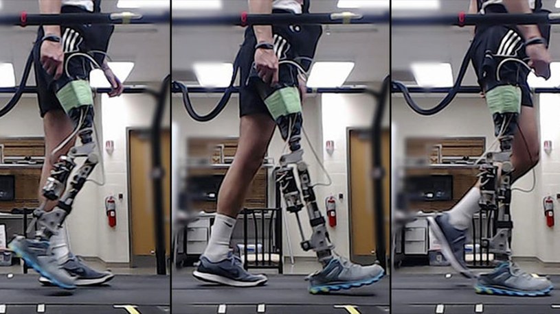 Robotyczna proteza sterowana AI przełomem w chodzeniu po amputacji /Geekweek