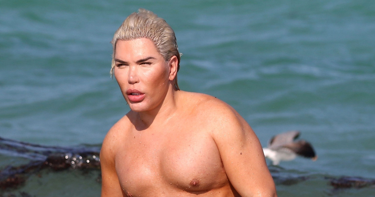 Rodrigo Alves /Agencja FORUM