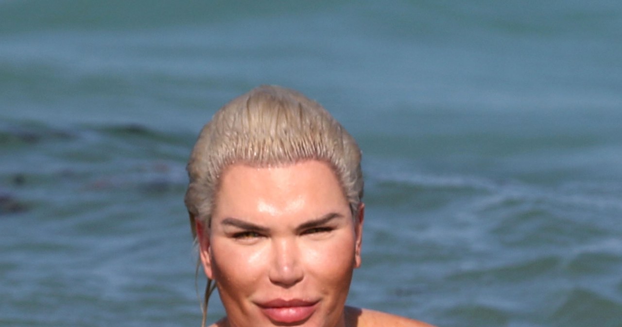 Rodrigo Alves /Agencja FORUM