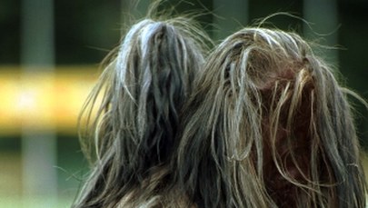 Rodzeństwo znęcało się nad psami. Zwierzęta są w opłakanym stanie