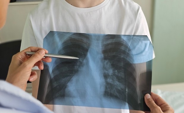 Rodzic: Wyglądało jak zwykła infekcja, a skończyło się szpitalem. To epidemia?