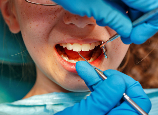 Rodzice mają tendencję do lekceważenia problemu próchnicy u dzieci, zwłaszcza jeśli dotyczy ona mlecznych zębów /123RF/PICSEL