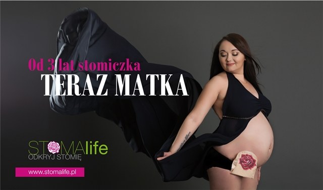 Roksana Mikołajczak, bohaterka fotografii, jest pierwszą Polką, która mając wyłonioną stomię odważyła się publicznie pokazać swoje ciążowe zdjęcie. /materiały prasowe