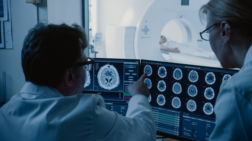 Ropień mózgu w badaniu tomografii daje obraz pierścienia z ciemnym obszarem mózgu w środku /123RF/PICSEL