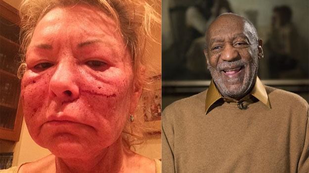 Roseanne Barr: Kolejna "ofiara" Billa Cosby'ego? - fot. Twitter/AP /