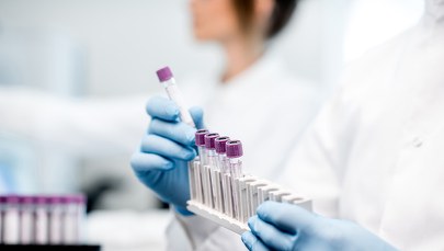 Rosja oskarża Polskę o badania nad wścieklizną w Ukrainie. Odpowiedź polskiej uczelni